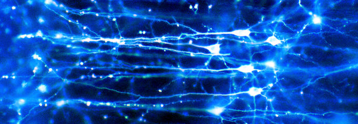 neurones viewed under a microscope
